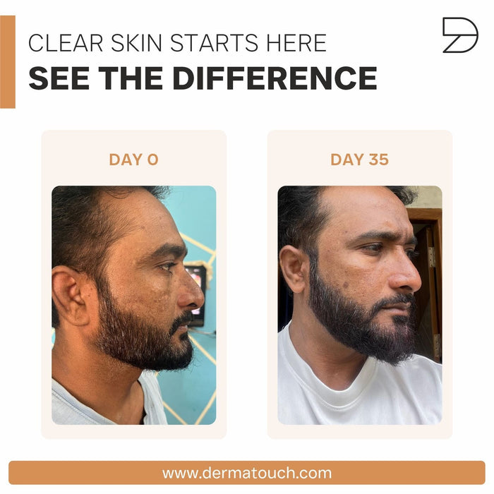 Bye Bye Pigmentation Kit