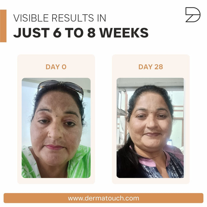 Bye Bye Pigmentation Kit